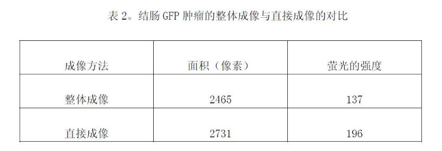 结肠肿瘤的影像测定